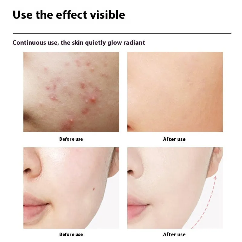 Advanced Photon Skincare Device – Rejuvenating Massage & Light Therapy