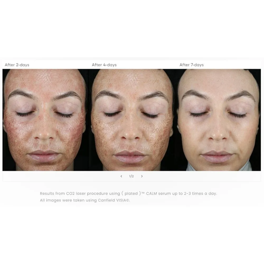 Plated Skin Science CALM Post-Procedure Serum